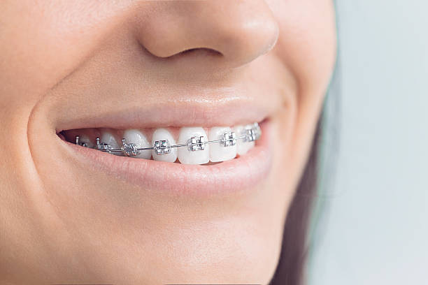 Best Crowns and Bridges  in Kettering, MD